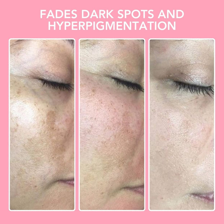 Kurkuma Kojic Acid Rengöringspads - GlowTonic
